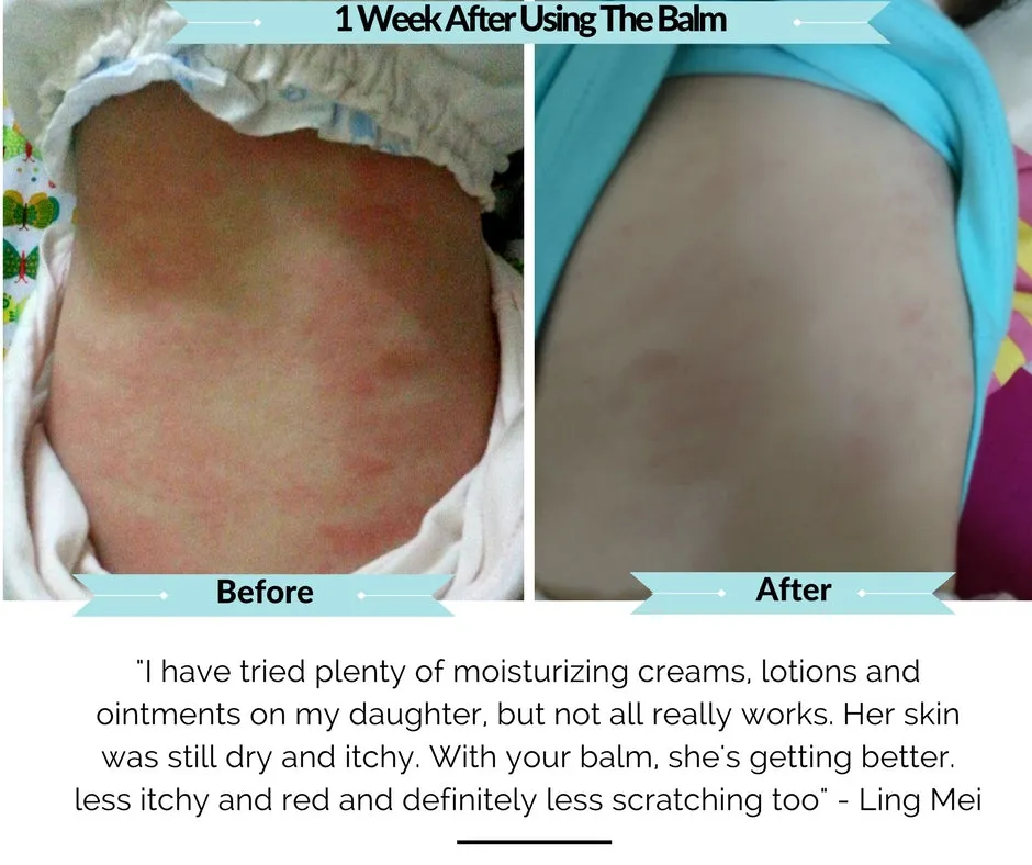 Conqueror Soothing Dry Skin Balm
