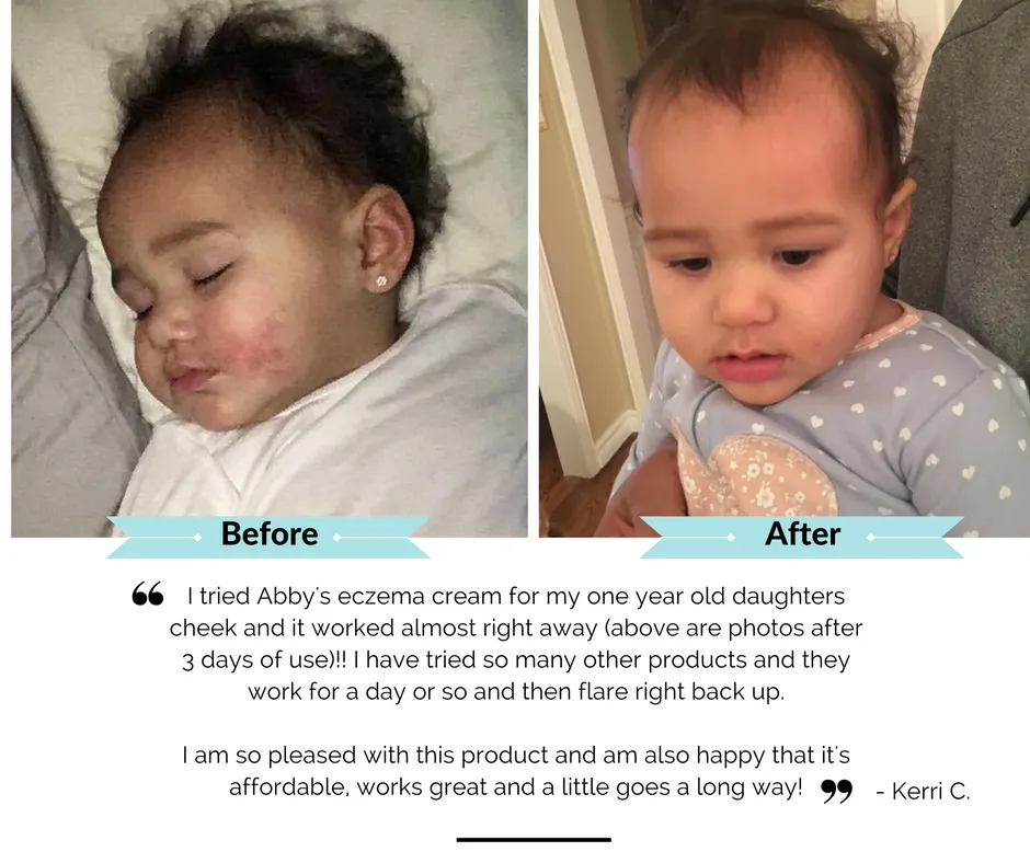 Conqueror Soothing Dry Skin Balm